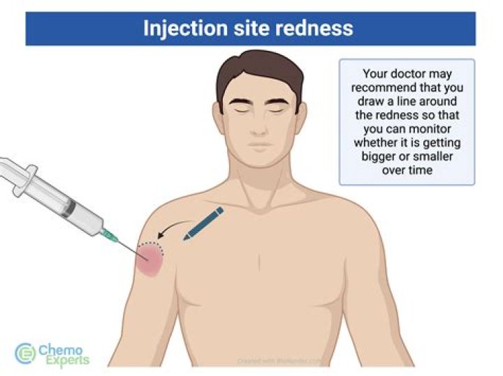 What does the Injection Gun do?